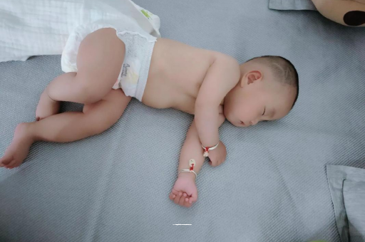 丰城六个月宝宝眼睛散光